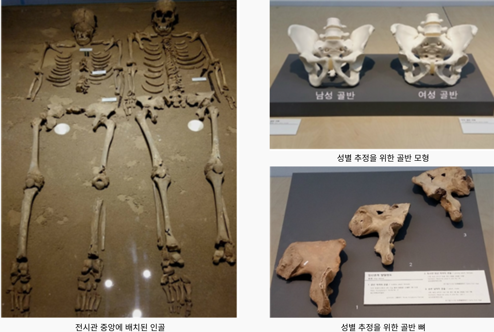 국립김해박물관